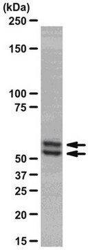 Anti-Smad2/3 Antibody, clone C4T, rabbit monoclonal culture supernatant, clone C4T, from rabbit