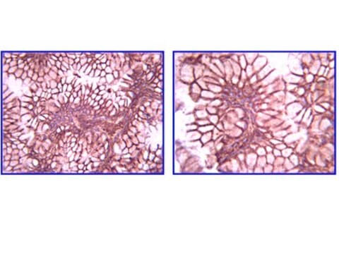 Anti-Laminin gamma 1 Antibody, clone A5 clone A5, Chemicon&#174;, from rat