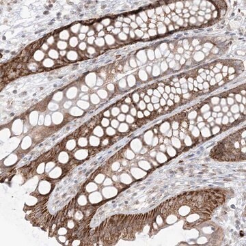 Anti-UBE2E2 antibody produced in rabbit Prestige Antibodies&#174; Powered by Atlas Antibodies, affinity isolated antibody, buffered aqueous glycerol solution