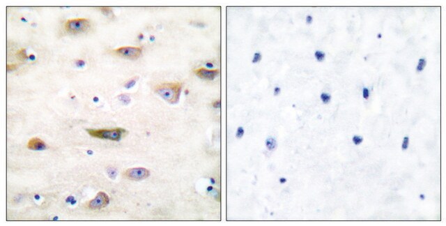 Anti-GLUR2 antibody produced in rabbit affinity isolated antibody