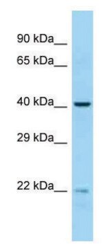 Anti-EME2 antibody produced in rabbit affinity isolated antibody