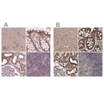 Anti-SUCLA2 antibody produced in rabbit Prestige Antibodies&#174; Powered by Atlas Antibodies, affinity isolated antibody