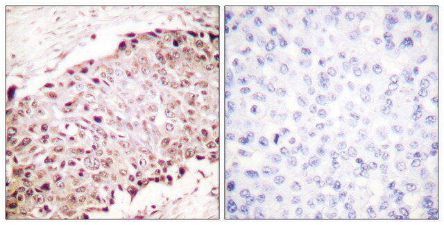 Anti-SUMO1, N-Terminal antibody produced in rabbit affinity isolated antibody