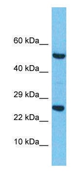 Anti-RRAS2 (C-terminal) antibody produced in rabbit affinity isolated antibody