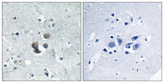 Anti-IBP7 antibody produced in rabbit affinity isolated antibody