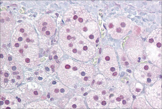 Anti-NR4A1 antibody produced in rabbit affinity isolated antibody