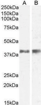 Anti-IL12B/IL12P40 (AB2) antibody produced in goat affinity isolated antibody, buffered aqueous solution