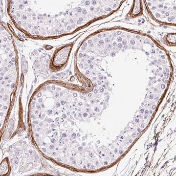 Anti-LOXL4 antibody produced in rabbit Prestige Antibodies&#174; Powered by Atlas Antibodies, affinity isolated antibody, buffered aqueous glycerol solution