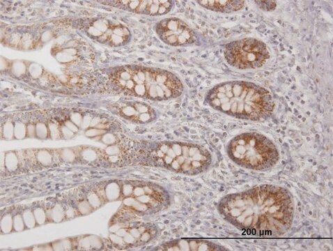 Anti-TFAM antibody produced in mouse purified immunoglobulin, buffered aqueous solution