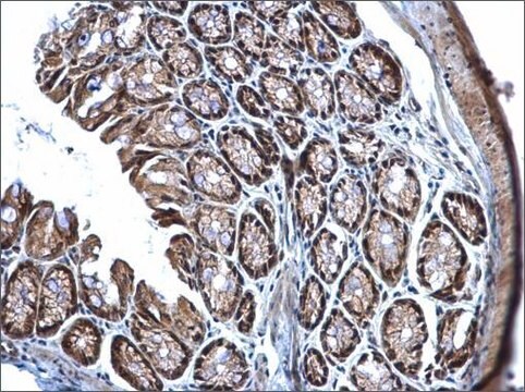 Anti-TET3 (C-terminal) antibody produced in rabbit affinity isolated antibody, buffered aqueous solution