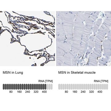 Anti-MSN antibody produced in rabbit Prestige Antibodies&#174; Powered by Atlas Antibodies, affinity isolated antibody, buffered aqueous glycerol solution