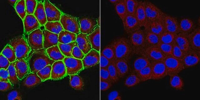 Anti-UDP-Galactose Transporter Antibody, clone 1H10.1 clone 1H10.1, from mouse