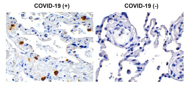 Anti-SARS-CoV-2 (COVID-19) NSP8 antibody produced in rabbit affinity isolated antibody