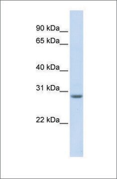 Anti-MARCH8 antibody produced in rabbit affinity isolated antibody