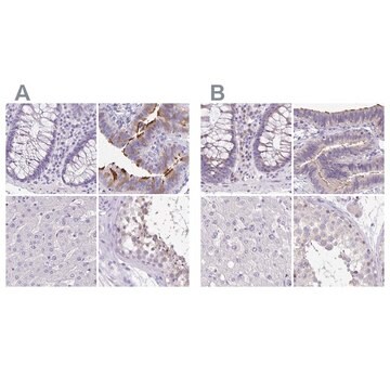 Anti-ANKRD45 antibody produced in rabbit Prestige Antibodies&#174; Powered by Atlas Antibodies, affinity isolated antibody, buffered aqueous glycerol solution, ab2