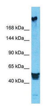 Anti-PREX2 (N-terminal) antibody produced in rabbit affinity isolated antibody