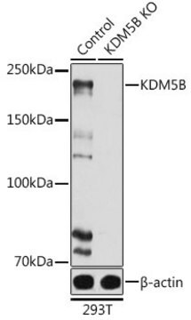 Anti- KDM5B antibody produced in rabbit