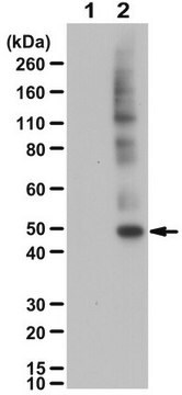 Anti-phospho-Keratin-18 Antibody (Ser52) from rabbit, purified by affinity chromatography