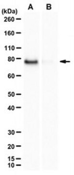 Anti-Prelamin-A Antibody, clone 3C8