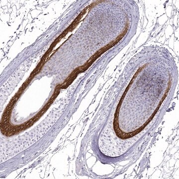 Anti-KRT71 antibody produced in rabbit Prestige Antibodies&#174; Powered by Atlas Antibodies, affinity isolated antibody, buffered aqueous glycerol solution