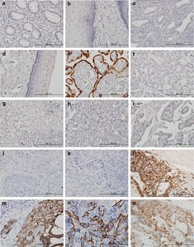 Monoclonal Anti-HSD3B1 antibody produced in mouse clone 3C11-D4, purified immunoglobulin, buffered aqueous solution