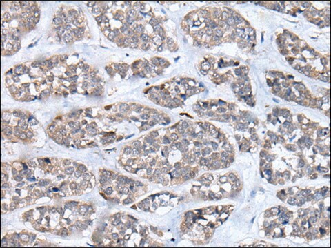 Anti-CD274 affinity isolated antibody