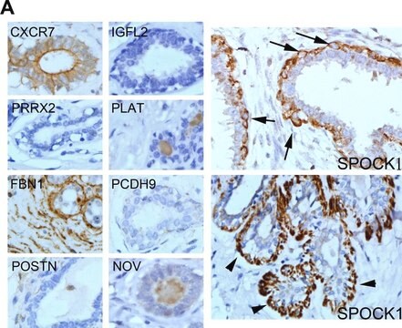 Anti-SPOCK1 antibody produced in rabbit Prestige Antibodies&#174; Powered by Atlas Antibodies, affinity isolated antibody, buffered aqueous glycerol solution