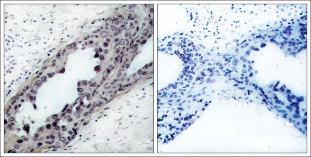 Anti-phospho-PTEN (pSer380/pThr382/pThr383) antibody produced in rabbit affinity isolated antibody