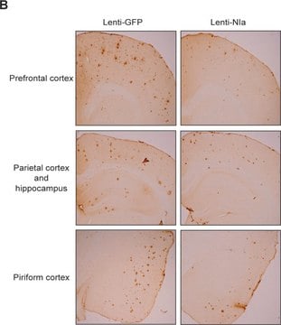 抗&#946;アミロイド抗体、マウスモノクローナル マウス宿主抗体 clone BAM-10, ascites fluid