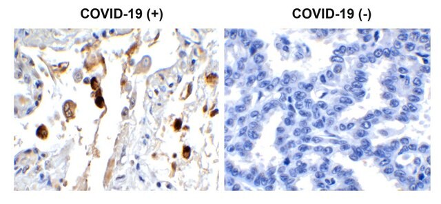 Anti-SARS-CoV-2 (COVID-19) Membrane antibody produced in rabbit affinity isolated antibody