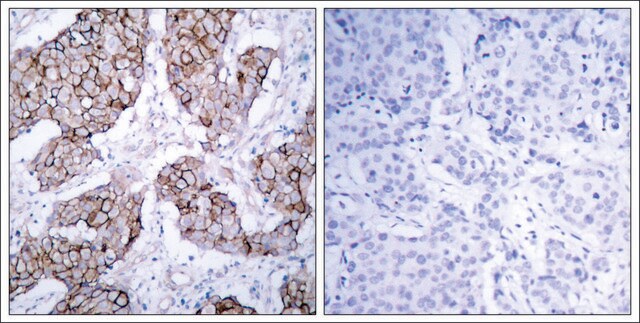 Anti-phospho-EGFR (pTyr1092) antibody produced in rabbit affinity isolated antibody