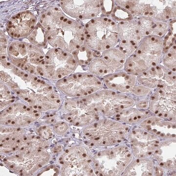 Anti-NMNAT1 antibody produced in rabbit Prestige Antibodies&#174; Powered by Atlas Antibodies, affinity isolated antibody, buffered aqueous glycerol solution