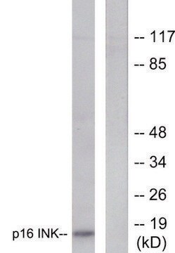 Anti-p16 INK antibody produced in rabbit affinity isolated antibody