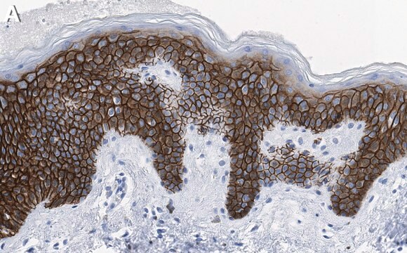 Anti-CD44 Antibody, clone 5H23 Antibody, ZooMAb&#174; Rabbit Monoclonal recombinant, expressed in HEK 293 cells