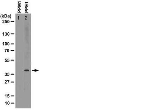 Anti-methyl-PP2A Antibody, C subunit, clone 2A10 clone 2A10, from mouse