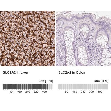 Anti-SLC2A2 antibody produced in rabbit Prestige Antibodies&#174; Powered by Atlas Antibodies, affinity isolated antibody, buffered aqueous glycerol solution