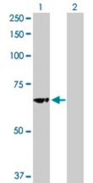 Anti-GBA antibody produced in rabbit purified immunoglobulin, buffered aqueous solution