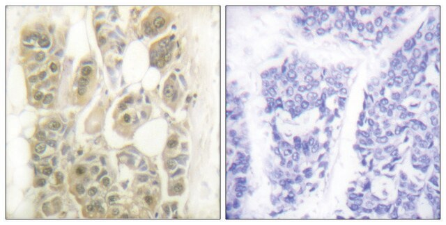 Anti-SSB antibody produced in rabbit affinity isolated antibody