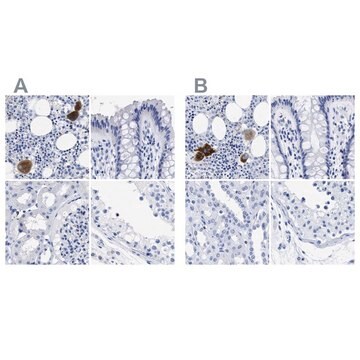 Anti-TREML1 antibody produced in rabbit Prestige Antibodies&#174; Powered by Atlas Antibodies, affinity isolated antibody, buffered aqueous glycerol solution