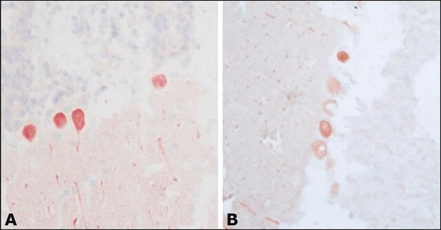 Anti-Calbindin-D-28K (KD-15) antibody produced in rabbit affinity isolated antibody, buffered aqueous solution