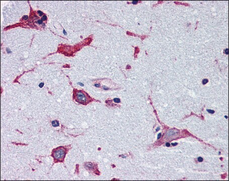 Anti-ADORA2B antibody produced in rabbit affinity isolated antibody