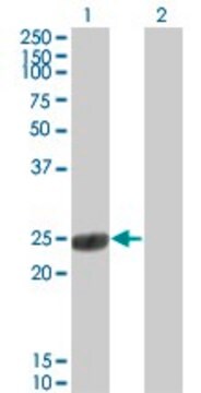 Monoclonal Anti-COMT antibody produced in mouse clone 1G4-1A1, purified immunoglobulin, buffered aqueous solution