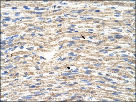 Anti-CARF antibody produced in rabbit IgG fraction of antiserum