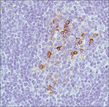 Anti-CD138 antibody, Rabbit monoclonal recombinant, expressed in proprietary host, clone SP152, affinity isolated antibody