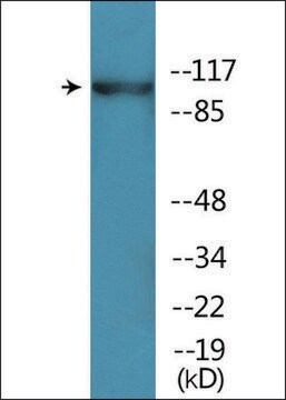 Anti-phospho-ACK1 (pTyr284) antibody produced in rabbit affinity isolated antibody