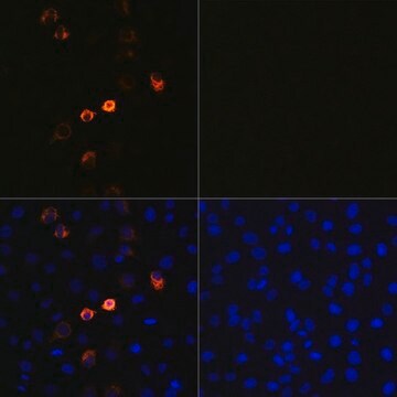 Monoclonal Anti-2019-nCoV Spike antibody produced in Rabbit