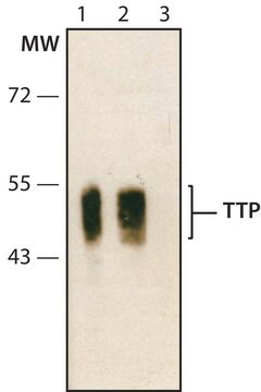 Anti-TTP (C-terminal) antibody produced in rabbit ~1.0&#160;mg/mL, affinity isolated antibody, buffered aqueous solution