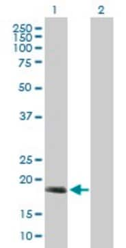 Anti-C17ORF49 antibody produced in mouse purified immunoglobulin, buffered aqueous solution