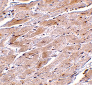 Anti-TRPC3 antibody produced in rabbit affinity isolated antibody