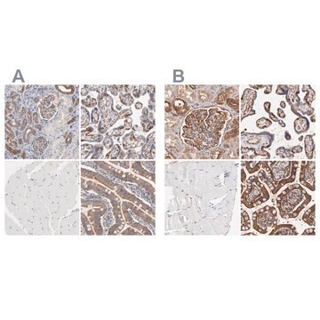 Anti-CD2AP antibody produced in rabbit Ab1, Prestige Antibodies&#174; Powered by Atlas Antibodies, affinity isolated antibody, buffered aqueous glycerol solution